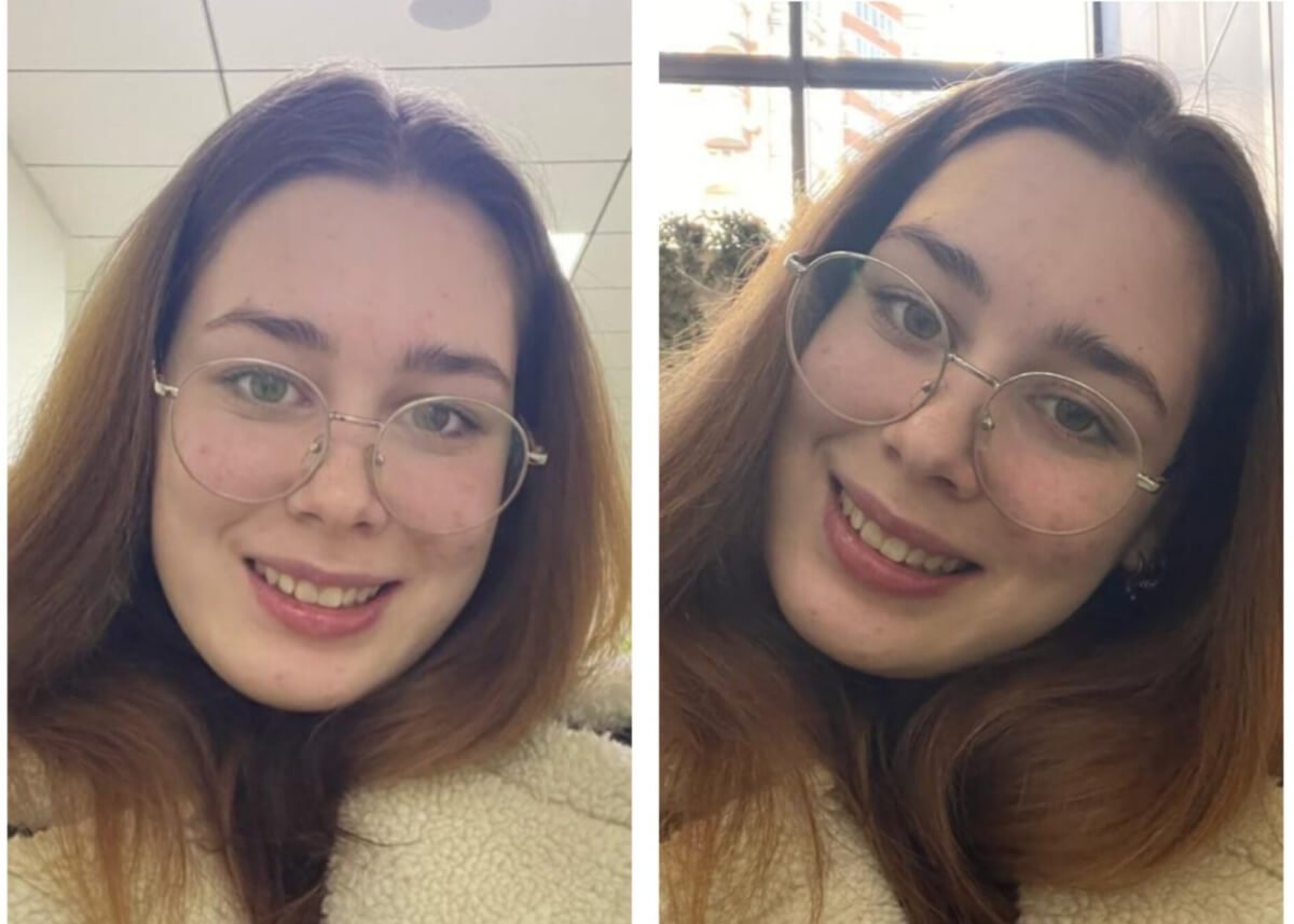 Посмішки від “Професорської стоматології  Любченко” (english version below)