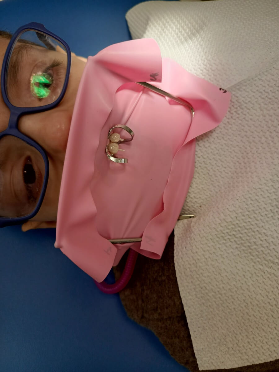 Новини з “Професорської стоматології Любченко” (english version below)