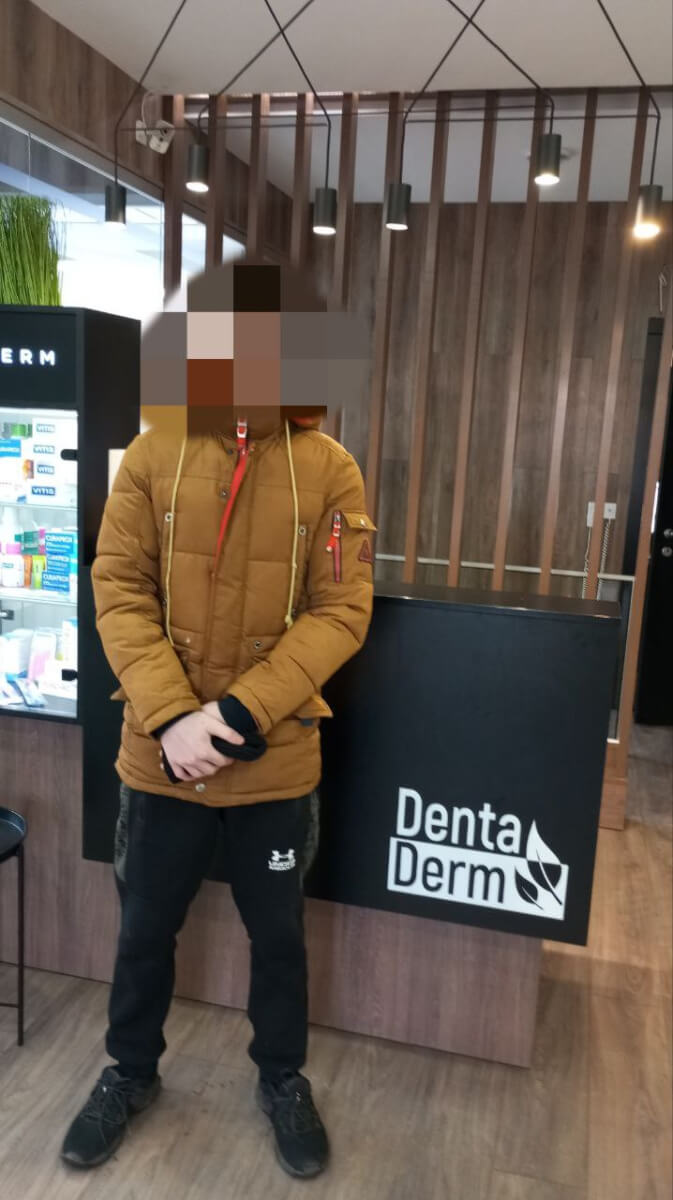 Лікування в “DentaDerm”