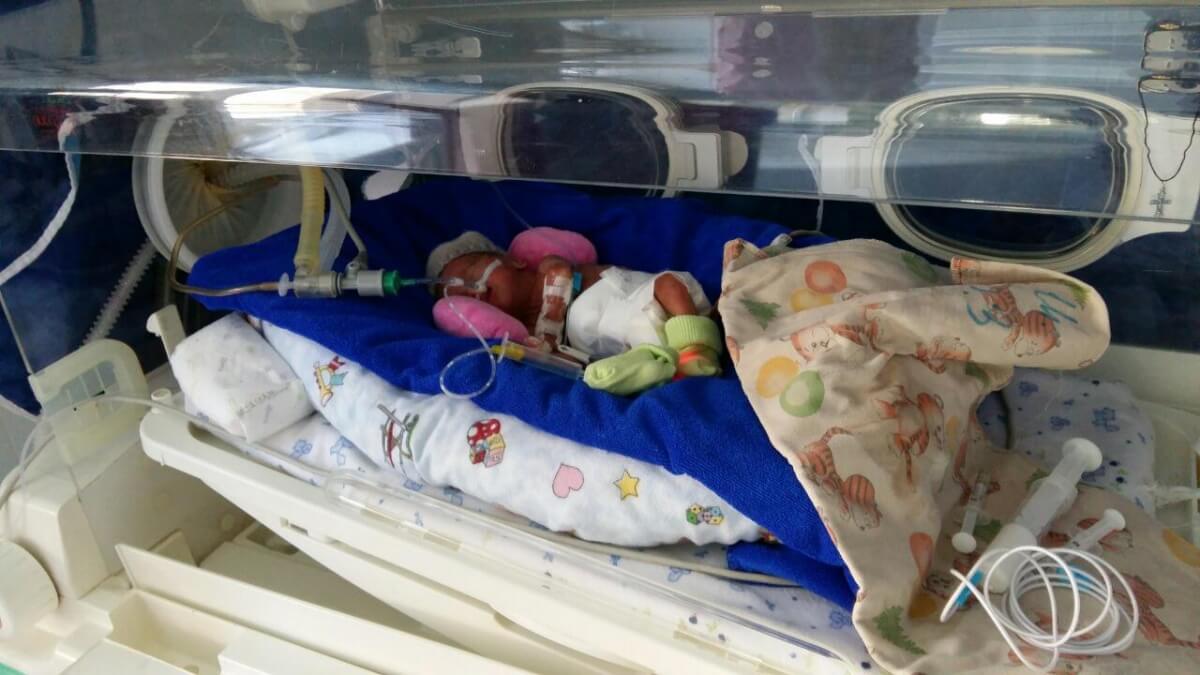 Максим, який народився на 23-му тижні вагітності потребує  допомоги!