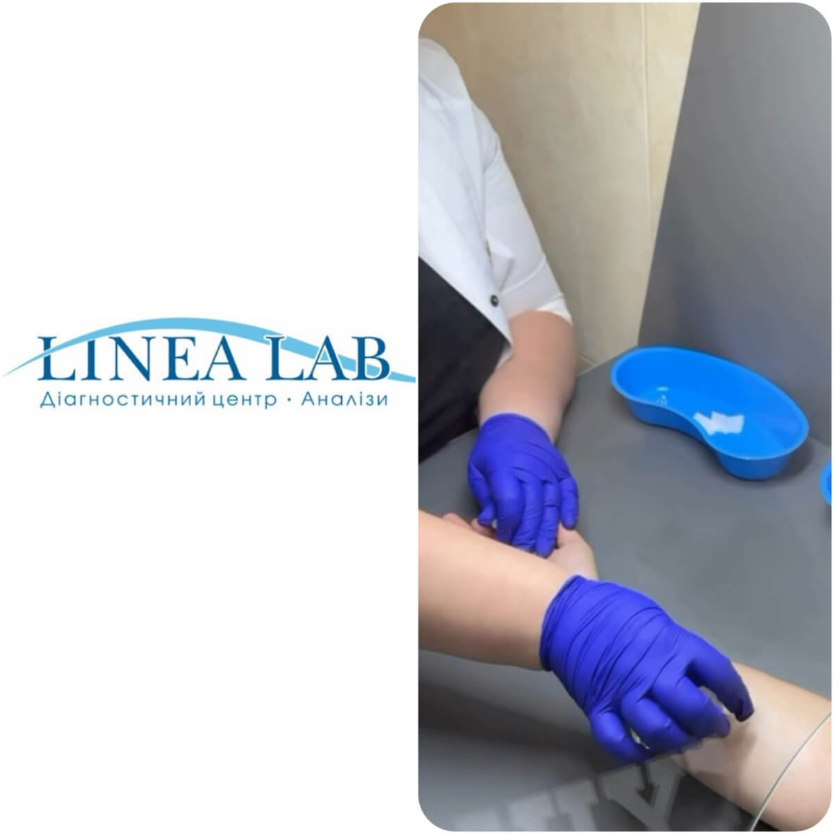 Діагностика в  “Linea.lab” (english version below)