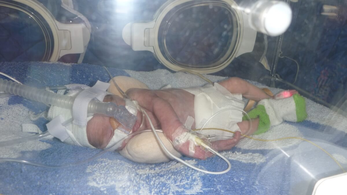 ТЕРМІНОВО! У військового із зони АТО передчасно народився син, потрібна допомога!